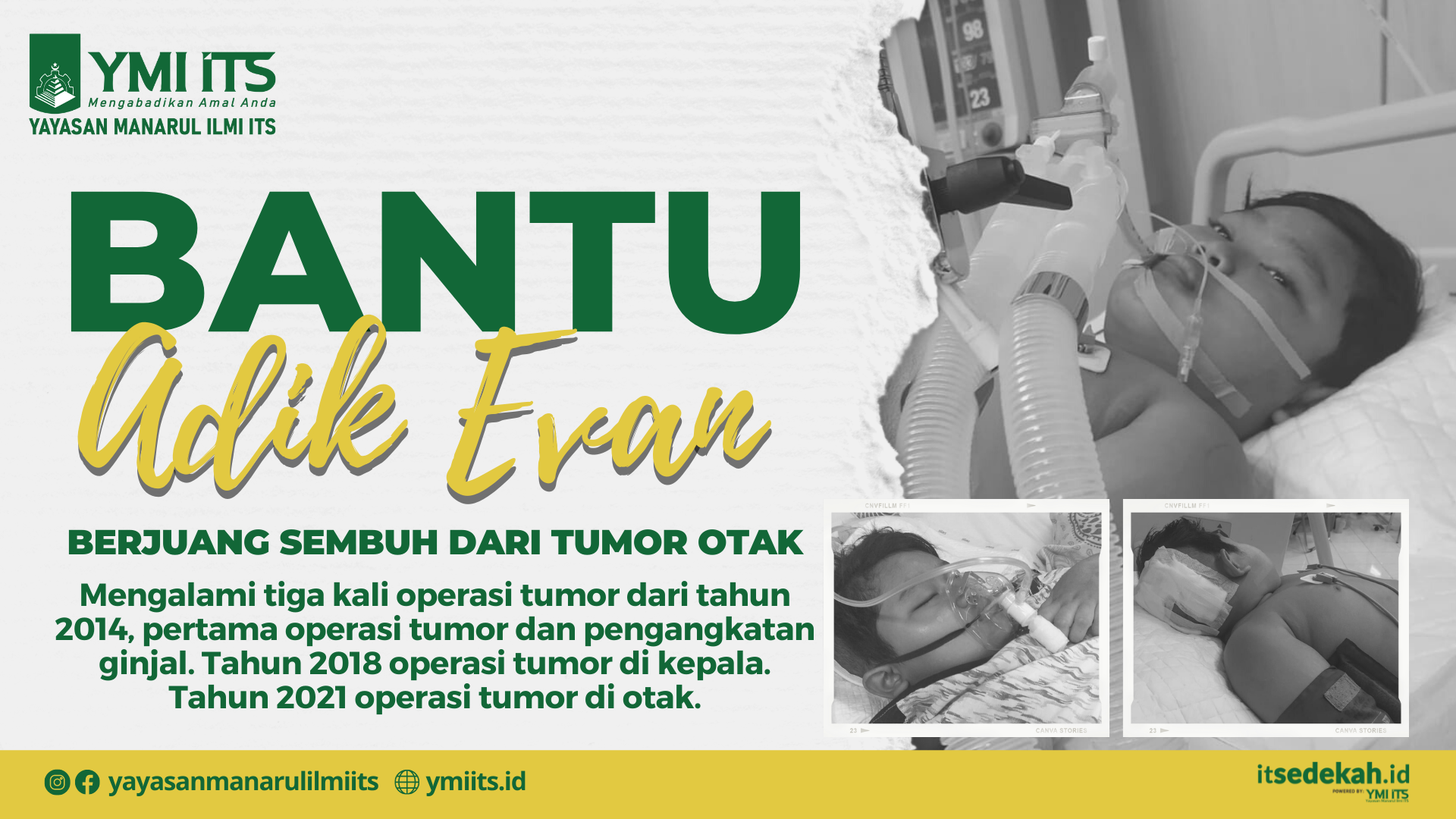Bantu Adik Evan Sembuh Dari Tumor Otak
